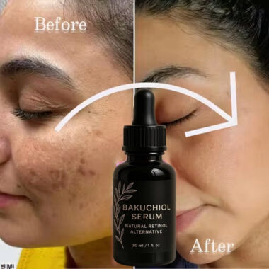 Retinol, Niacinamide, Vitamin C, Hyaluronic Acid, AntiAging Wrinkle SERUM